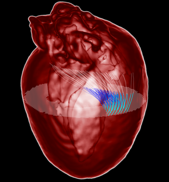 Heart wall myofibers are arranged in minimal surfaces to optimize organ function